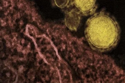 Что такое коронавирусы и как защититься от коронавируса 2019-nCoV